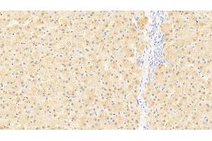 Detection of LMTK3 in Human Liver Tissue using Polyclonal Antibody to Lemur Tyrosine Kinase 3 (LMTK3) (LMTK3 抗体  (AA 133-411))