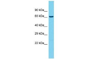 Host: Rabbit  Target Name: Ubash3b  Sample Tissue: Rat Testis lysates  Antibody Dilution: 1. (UBASH3B 抗体  (C-Term))