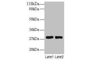Western blot All lanes: MPZ antibody at 2 μg/mL Lane 1: 293T whole cell lysate Lane 2: EC109 whole cell lysate Secondary Goat polyclonal to rabbit IgG at 1/15000 dilution Predicted band size: 28, 35 kDa Observed band size: 28 kDa (MPZ 抗体  (AA 30-156))
