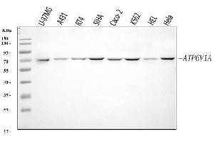 Western blot analysis of ATP6V1A using anti-ATP6V1A antibody (ABIN7599916).
