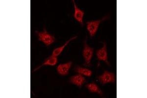ABIN6272244 staining HeLa by IF/ICC. (ARHGAP1 抗体  (Internal Region))
