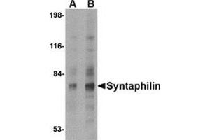 Western blot analysis of Syntaphilin in human brain tissue lysate with this product at (A) 2 and (B) 4 μg/ml. (Syntaphilin 抗体  (N-Term))