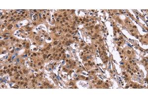 Immunohistochemistry (Paraffin-embedded Sections) (IHC (p)) image for anti-Inhibitor of DNA Binding 4, Dominant Negative Helix-Loop-Helix Protein (ID4) antibody (ABIN7243412)