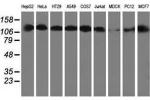 Western blot analysis of extracts (35 µg) from 9 different cell lines by using anti-HDAC6 monoclonal antibody. (HDAC6 抗体)