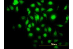 Immunofluorescence of monoclonal antibody to BAG1 on HeLa cell. (BAG1 抗体  (AA 241-345))