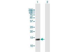 Western Blot analysis of RAB28 expression in transfected 293T cell line by RAB28 MaxPab polyclonal antibody. (RAB28 抗体  (AA 1-95))