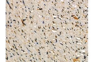 Phospho-SNAIL (Ser11) Antibody at 1/100 staining Rat heart tissue by IHC-P. (SNAIL 抗体  (pSer11))