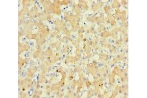 Immunohistochemistry of paraffin-embedded human liver tissue using ABIN7167868 at dilution of 1:100 (RS1 抗体  (AA 24-224))