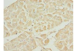 IHC analysis of paraffin-embedded human heart tissue using TNNI3K antibody (1/100 dilution). (TNNI3K 抗体  (AA 1-75))