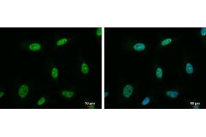 ICC/IF Image NRF1 antibody detects NRF1 protein at nucleus by immunofluorescent analysis. (NRF1 抗体)