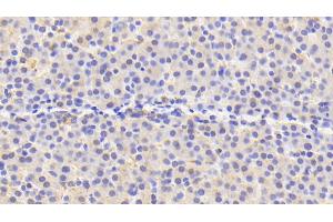 Detection of PRDX4 in Human Liver Tissue using Polyclonal Antibody to Peroxiredoxin 4 (PRDX4) (Peroxiredoxin 4 抗体  (AA 6-249))