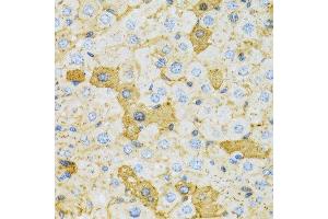 Immunohistochemistry of paraffin-embedded rat liver using OXA1L antibody. (OXA1L 抗体  (AA 396-495))