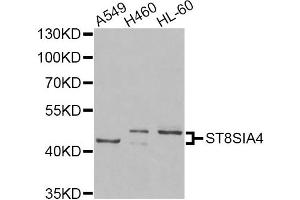 Western blot analysis of extracts of various cell lines, using ST8SIA4 Antibody (ABIN5975704) at 1/1000 dilution. (ST8SIA4 抗体)