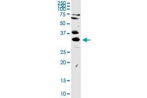 Western Blotting (WB) image for anti-three Prime Repair Exonuclease 1 (TREX1) (AA 1-369) antibody (ABIN524703)