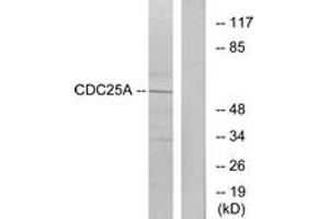 Western blot analysis of extracts from A2780 cells, treated with UV, using CDC25A (Ab-75) Antibody. (CDC25A 抗体  (AA 43-92))