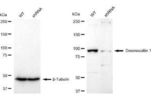 Western blotting analysis using Desmocollin 1 antibody (ABIN7798315). (Recombinant Desmocollin 1 抗体)