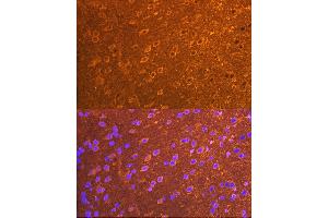 Immunofluorescence analysis of mouse brain cells using PSD93/chapsyn-110/DLG2 Rabbit mAb (ABIN7266793) at dilution of 1:100 (40x lens).