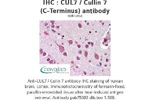 Image no. 1 for anti-Cullin 7 (CUL7) antibody (ABIN1733382) (Cullin 7 抗体)