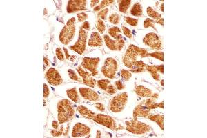Antibody staining PCCA in human heart tissue sections by Immunohistochemistry (IHC-P - paraformaldehyde-fixed, paraffin-embedded sections). (PCCA 抗体  (AA 362-390))