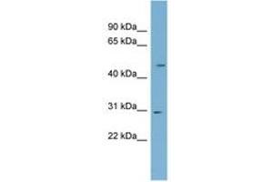 Image no. 1 for anti-NADH Dehydrogenase (Ubiquinone) Fe-S Protein 3, 30kDa (NADH-Coenzyme Q Reductase) (NDUFS3) (AA 179-228) antibody (ABIN6744092)