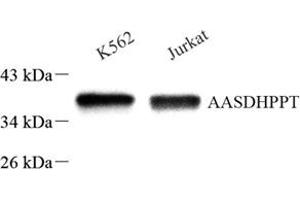 Western blot analysis of AASD-PPT (ABIN7073034) at dilution of 1: 500 (AASDHPPT 抗体)