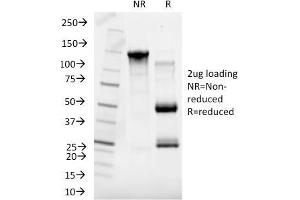 SDS-PAGE Analysis Purified SHBG Mouse Monoclonal Antibody (SHBG/245). (SHBG 抗体)