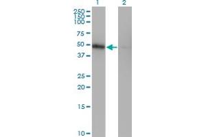 Western Blot analysis of ZNF24 expression in transfected 293T cell line by ZNF24 monoclonal antibody (M03), clone 4C2. (ZNF24 抗体  (AA 1-368))