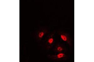 Immunofluorescence (IF) image for anti-Cofilin 1 (CFL1) (N-Term), (pSer3) antibody (ABIN7296066)
