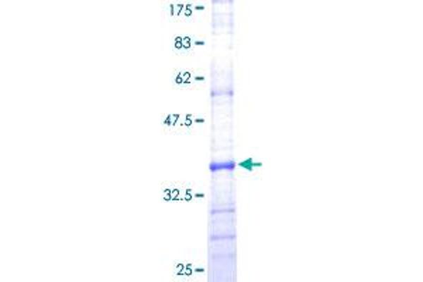 PEX7 Protein (AA 2-99) (GST tag)