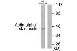 Western blot analysis of extracts from rat muscle cells, using Actin-alpha-1 Antibody. (Actin 抗体  (AA 1-50))