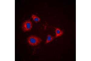 Immunofluorescence (IF) image for anti-Protein Kinase, CAMP-Dependent, Regulatory, Type I, alpha (Tissue Specific Extinguisher 1) (PRKAR1A) (C-Term) antibody (ABIN7296678)