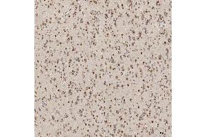 IHC analysis of U1A/SNRPA using anti-U1A/SNRPA antibody (ABIN7600891). (SNRPA1 抗体  (AA 25-218))