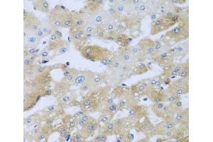 Immunohistochemistry of paraffin-embedded Human liver damage using AP1M2 Polyclonal Antibody at dilution of 1:100 (40x lens). (AP1m2 抗体)
