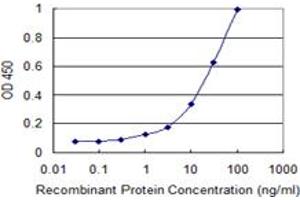 Detection limit for recombinant GST tagged L1CAM is 0. (L1CAM 抗体  (AA 23-132))