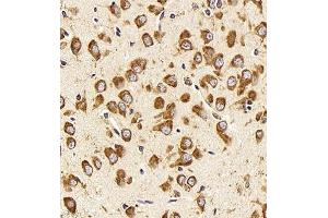 Immunohistochemistry (Paraffin-embedded Sections) (IHC (p)) image for anti-Neurotensin (NTS) antibody (ABIN7074827)