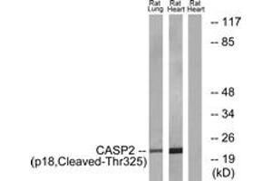 Western blot analysis of extracts from rat heart/rat lung cells, using Caspase 2 (p18,Cleaved-Thr325) Antibody. (Caspase 2 抗体  (Cleaved-Thr325))