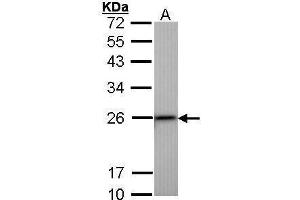 WB Image Sample (30 ug of whole cell lysate) A: Hep G2 , 12% SDS PAGE antibody diluted at 1:1000 (Transgelin 抗体)