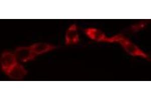 ABIN6274076 staining HeLa cells by IF/ICC. (FADD 抗体  (pSer194))