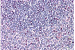 Spleen, Human: Formalin-Fixed, Paraffin-Embedded (FFPE) (NCOA3 抗体  (AA 188-198))