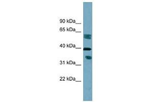 DHRS7B antibody used at 1 ug/ml to detect target protein. (DHRS7B 抗体)