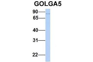Host:  Rabbit  Target Name:  GOLGA5  Sample Type:  Human 293T  Antibody Dilution:  1. (GOLGA5 抗体  (N-Term))