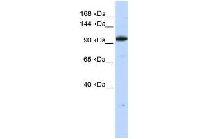 WB Suggested Anti-ZNF228 Antibody Titration:  0.