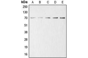Western blot analysis of Acetylcholinesterase expression in HeLa (A), HEK293T (B), mouse liver (C), rat kidney (D), PC12 (E) whole cell lysates. (Acetylcholinesterase 抗体  (Center))