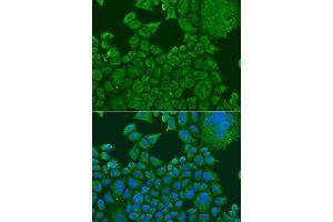 Immunofluorescence analysis of U2OS cells using FXR1 antibody. (FXR1 抗体  (AA 250-350))