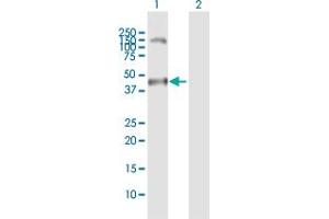 Western Blot analysis of MAGEA11 expression in transfected 293T cell line by MAGEA11 MaxPab polyclonal antibody. (MAGEA11 抗体  (AA 1-319))