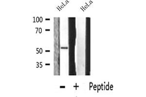 Western blot analysis on HeLa cell lysate using MMP-13 Antibody (MMP13 抗体  (N-Term))