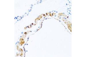 Immunohistochemistry of paraffin-embedded rat lung using PHPT1 antibody. (PHPT1 抗体  (AA 1-125))