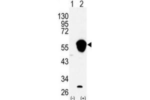 Western Blotting (WB) image for anti-Aldehyde Dehydrogenase 3 Family, Member A1 (ALDH3A1) antibody (ABIN3003526)