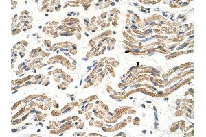 Immunohistochemistry (IHC) image for anti-Aldehyde Dehydrogenase 4 Family, Member A1 (ALDH4A1) (C-Term) antibody (ABIN2782324) (ALDH4A1 抗体  (C-Term))