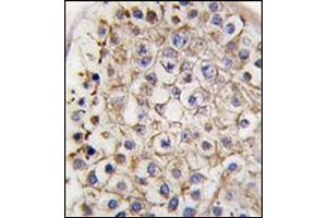 Immunohistochemistry (Paraffin-embedded Sections) (IHC (p)) image for anti-Microtubule-Associated Protein 1 Light Chain 3 beta (MAP1LC3B) (AA 88-118), (C-Term) antibody (ABIN1449627)